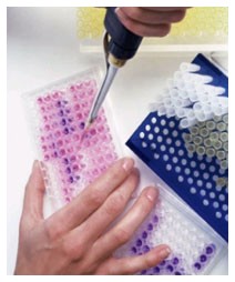 nuova terapia per il mieloma