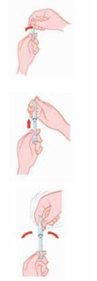 speedicath preparazione catetere bambina