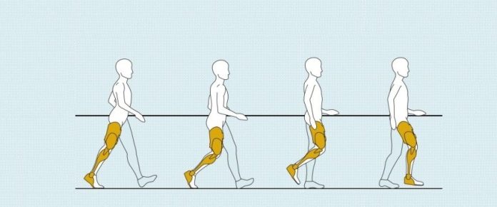 disegno che rappresenta una persona che indossa ortesi di gamba in varied fasi