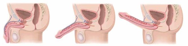 grafica che rappresenta tre momenti del pene durante una erezione