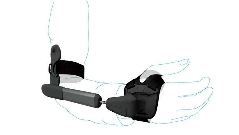Ortesi passiva che riduce il tremore agli arti superiori ortesi anti tremori